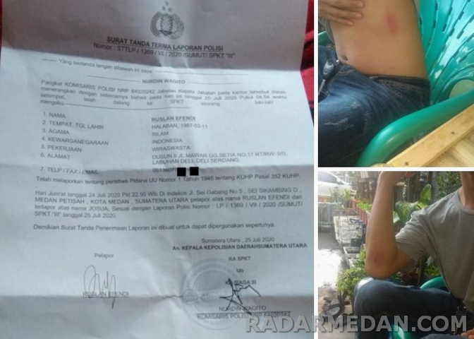 Dianyaya Oknum Polisi, Ruslan Lapor Polisi