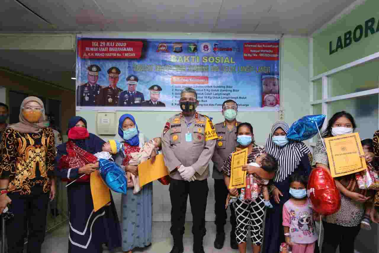 Dapat Bantuan Operasi Bibir Sumbing, Keluarga Pasien Ucapkan Terima Kasih Kepada Kapoldasu