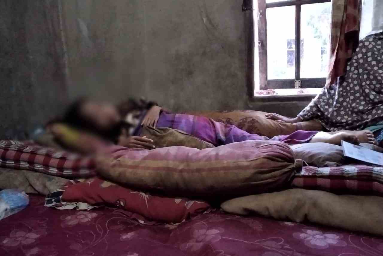 Remaja Putri Ini Hanya Terbaring di Tempat Tidur Butuh Perhatian Pemkab Asahan 