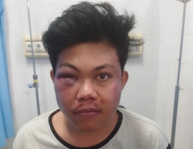 Kasus Penganiayaan di Samosir Buka Kembali, Korban Sebut Saat Perdamaian Ia Tidak Stabil